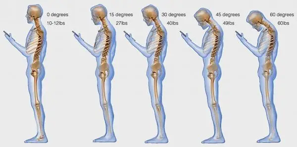 Health problems caused by Smartphones