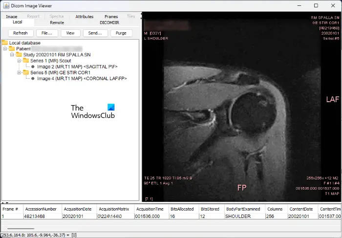 DICOM Image Viewer