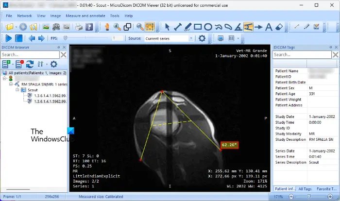 MicoDicom free DICOM viewer software